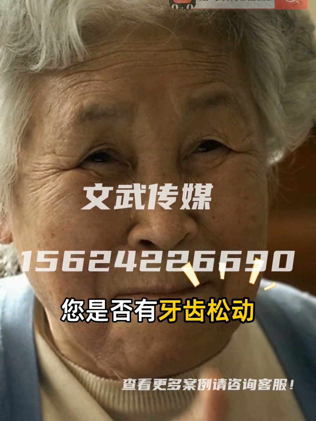 专业相机口播案例—信息流—口腔